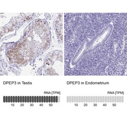DPEP3 Antibody, Novus Biologicals 25 &mu;L, Unlabeled:Antibodies, Polyclonal